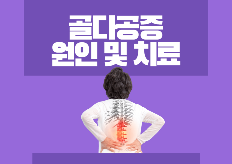 골다공증 원인 및 치료