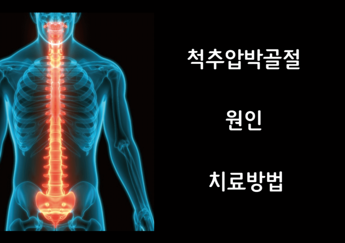척추압박골절 원인 및 치료방법